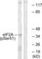 Eukaryotic Translation Initiation Factor 2 Subunit Alpha antibody, LS-C117341, Lifespan Biosciences, Western Blot image 
