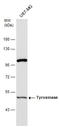 Tyrosinase antibody, GTX101094, GeneTex, Western Blot image 