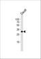 BCL10 Immune Signaling Adaptor antibody, M01616, Boster Biological Technology, Western Blot image 