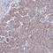 Calcium Release Activated Channel Regulator 2B antibody, HPA046217, Atlas Antibodies, Immunohistochemistry paraffin image 