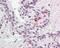 Kallikrein Related Peptidase 11 antibody, 49-842, ProSci, Immunohistochemistry paraffin image 