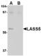 Ceramide Synthase 5 antibody, LS-B3152, Lifespan Biosciences, Western Blot image 