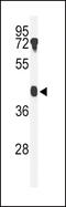 Beta-1,4-Galactosyltransferase 2 antibody, 63-963, ProSci, Western Blot image 