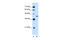 Glutamic-Oxaloacetic Transaminase 2 antibody, 29-877, ProSci, Enzyme Linked Immunosorbent Assay image 