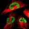 Thyroid Hormone Receptor Associated Protein 3 antibody, HPA012041, Atlas Antibodies, Immunocytochemistry image 