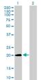 Sorting Nexin 24 antibody, H00028966-B01P, Novus Biologicals, Western Blot image 