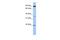 RING finger protein 219 antibody, PA5-42338, Invitrogen Antibodies, Western Blot image 