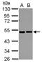 Eukaryotic Translation Initiation Factor 2 Subunit Beta antibody, NBP2-16290, Novus Biologicals, Western Blot image 