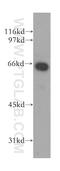 Kruppel Like Factor 12 antibody, 13156-1-AP, Proteintech Group, Western Blot image 