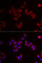 Mitogen-Activated Protein Kinase Kinase 5 antibody, 22-583, ProSci, Immunofluorescence image 