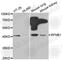 Ephrin B1 antibody, A2518, ABclonal Technology, Western Blot image 