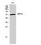 G1 To S Phase Transition 1 antibody, STJ92984, St John