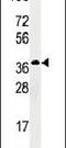 Ribokinase antibody, PA5-13993, Invitrogen Antibodies, Western Blot image 