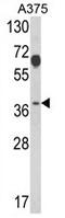 Proteasome 26S Subunit, Non-ATPase 7 antibody, AP17684PU-N, Origene, Western Blot image 