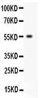 Erythropoietin Receptor antibody, PA2032, Boster Biological Technology, Western Blot image 