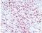 ORF73 antibody, NBP1-30176, Novus Biologicals, Immunohistochemistry paraffin image 