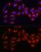 Hexokinase 1 antibody, GTX54080, GeneTex, Immunocytochemistry image 