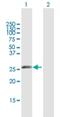 Immunoglobulin Kappa Variable 1-5 antibody, H00028299-B01P, Novus Biologicals, Western Blot image 