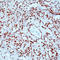 RB Transcriptional Corepressor 1 antibody, LS-C87513, Lifespan Biosciences, Immunohistochemistry paraffin image 