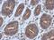 AXL Receptor Tyrosine Kinase antibody, GTX108560, GeneTex, Immunohistochemistry paraffin image 