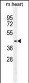 Adaptor Related Protein Complex 1 Subunit Mu 1 antibody, PA5-48177, Invitrogen Antibodies, Western Blot image 