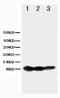 TNF Receptor Superfamily Member 13C antibody, LS-C312557, Lifespan Biosciences, Western Blot image 