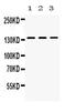 NPHS1 Adhesion Molecule, Nephrin antibody, PA5-79756, Invitrogen Antibodies, Western Blot image 