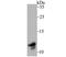 TYRO Protein Tyrosine Kinase Binding Protein antibody, NBP2-76828, Novus Biologicals, Western Blot image 