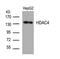 Histone Deacetylase 4 antibody, 79-557, ProSci, Western Blot image 