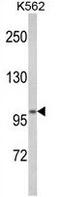 Potassium-transporting ATPase alpha chain 2 antibody, GTX81091, GeneTex, Western Blot image 