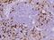 Indoleamine 2,3-Dioxygenase 1 antibody, 11650-T24, Sino Biological, Immunohistochemistry paraffin image 