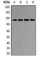 CD2 Associated Protein antibody, abx225089, Abbexa, Western Blot image 