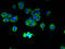 Transmembrane And Coiled-Coil Domain Family 1 antibody, A63572-100, Epigentek, Immunofluorescence image 