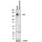 MER Proto-Oncogene, Tyrosine Kinase antibody, AF891, R&D Systems, Western Blot image 