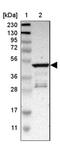 Pleckstrin Homology Domain Containing A1 antibody, NBP1-86967, Novus Biologicals, Western Blot image 