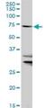 Solute Carrier Family 27 Member 1 antibody, H00376497-D01P, Novus Biologicals, Western Blot image 