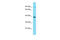 G Protein-Coupled Receptor 4 antibody, ARP64190_P050, Aviva Systems Biology, Western Blot image 