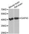 Growth Associated Protein 43 antibody, A6376, ABclonal Technology, Western Blot image 