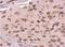 Ribosomal Protein L6 antibody, NBP2-20216, Novus Biologicals, Immunohistochemistry paraffin image 