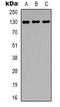 Epidermal Growth Factor antibody, LS-C368987, Lifespan Biosciences, Western Blot image 