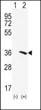 Arylamine N-acetyltransferase 2 antibody, PA5-49606, Invitrogen Antibodies, Western Blot image 