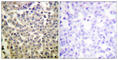 P21 (RAC1) Activated Kinase 1 antibody, abx012446, Abbexa, Western Blot image 