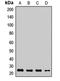 RAB18, Member RAS Oncogene Family antibody, LS-C668863, Lifespan Biosciences, Western Blot image 