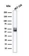 Keratin 8 antibody, GTX34671, GeneTex, Western Blot image 