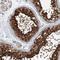 Heat Shock Protein Family A (Hsp70) Member 6 antibody, NBP1-85949, Novus Biologicals, Immunohistochemistry paraffin image 