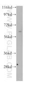 MLLT3 Super Elongation Complex Subunit antibody, 12825-1-AP, Proteintech Group, Western Blot image 