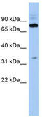 Protein FAM161B antibody, TA338853, Origene, Western Blot image 