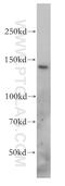 Solute Carrier Family 9 Member C2 (Putative) antibody, 17398-1-AP, Proteintech Group, Western Blot image 