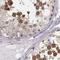 PDZ Binding Kinase antibody, NBP1-84342, Novus Biologicals, Immunohistochemistry paraffin image 
