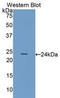 Heat Shock Protein Family B (Small) Member 8 antibody, LS-C294425, Lifespan Biosciences, Western Blot image 